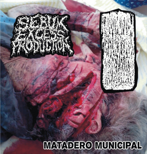 Sebum Excess Production : Matadero Municipal